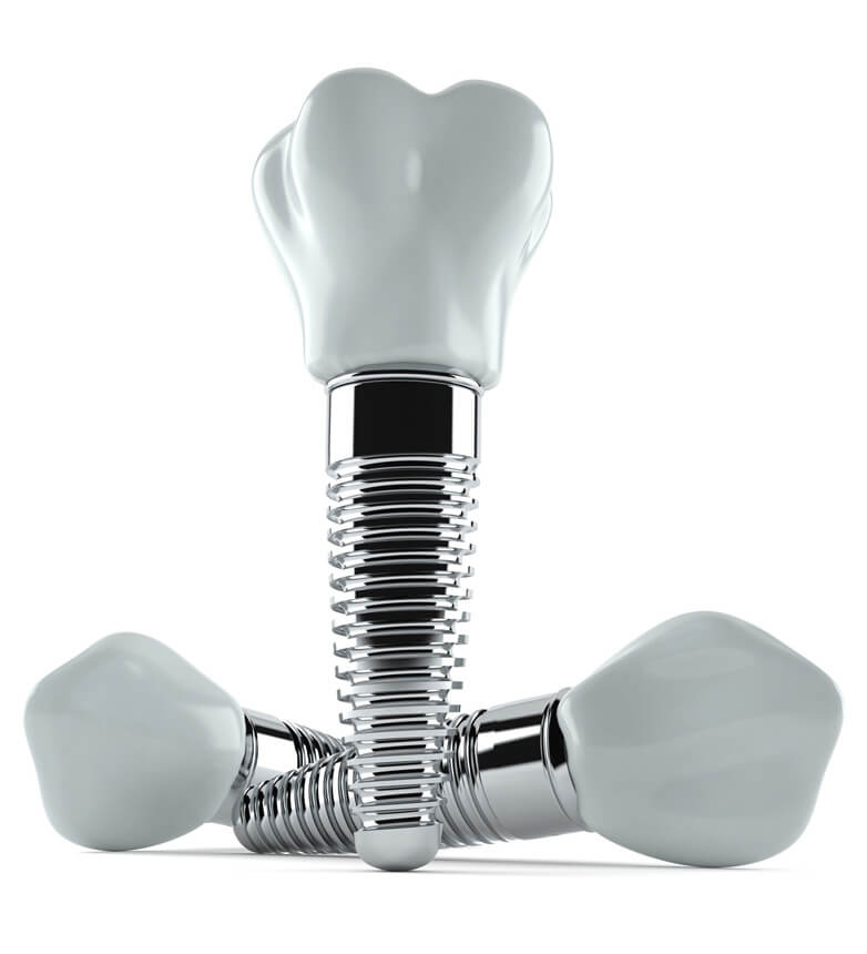 Three dental implants isolated